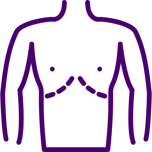 Cleft Lip Image